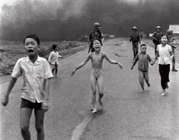 Attaque au Napalm durant la guerre au vietnam, cette jeune fille a du subir 17 greffes de peau (...)